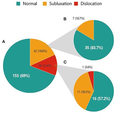 Point Prevalence and Associated Factors of Hip Displacement in Pediatric Patients With Mitochondrial Disease